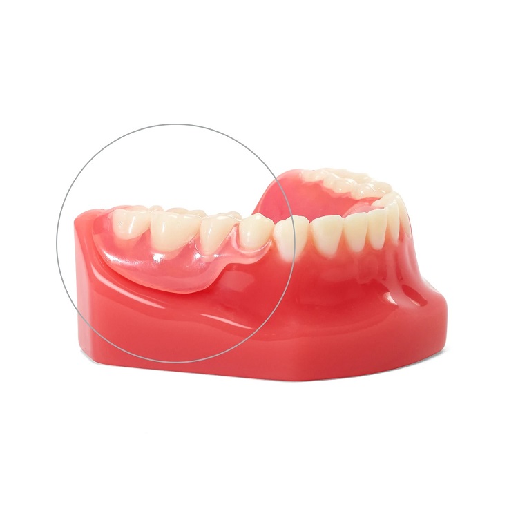 دندان مصنوعی ژله ای چیست؟