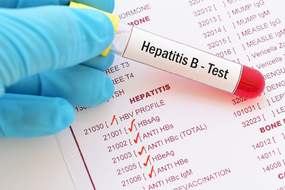 hepatitis-b-virus-test-872062776-fa48bdcc021b4db7a72c39510ad5bc6e