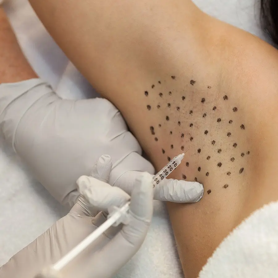  نقاط تزریق بوتاکس زیر بغل