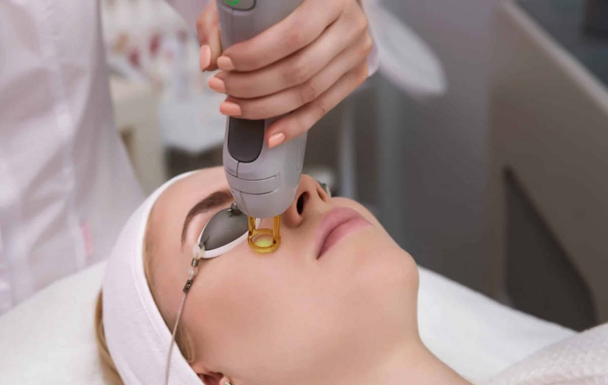 Laser-Skin-Treatment-1