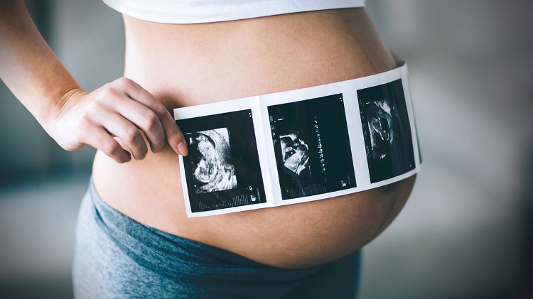 The-Truth-About-Baby-Ultrasound-by-Mama-Natural-scaled