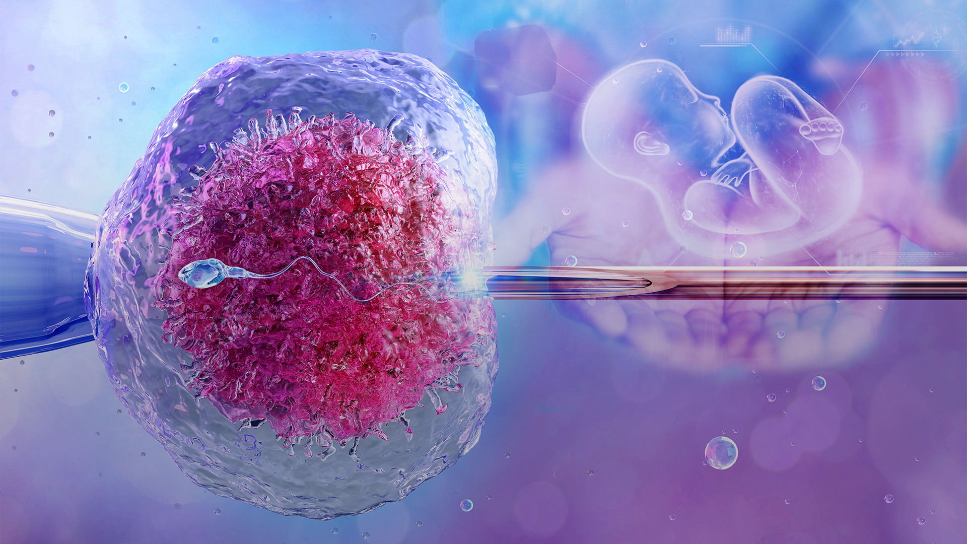 لقاح آزمایشگاهی (IVF)
