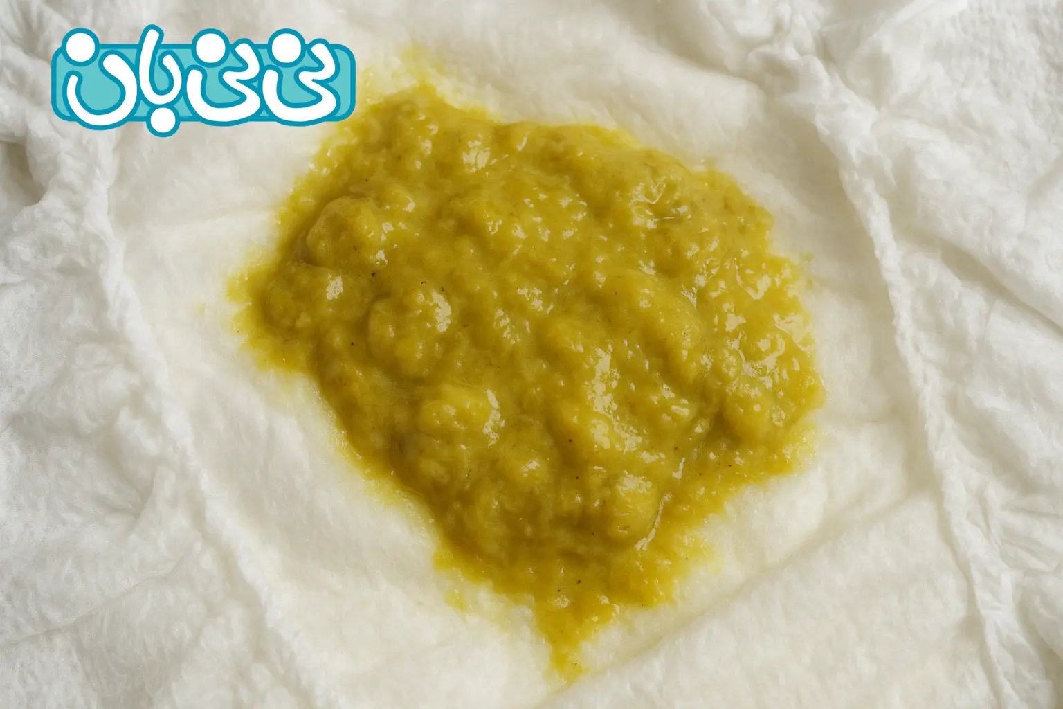 عکس مدفوع خلطی نوزاد