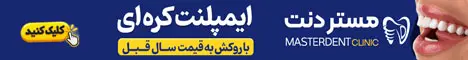 مستردنت - رندوم