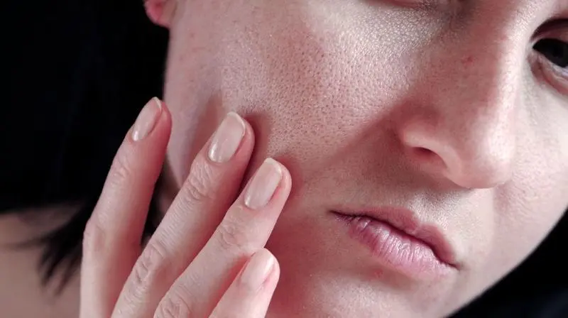 علل منافذ باز پوست