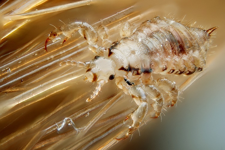 Male_human_head_louse