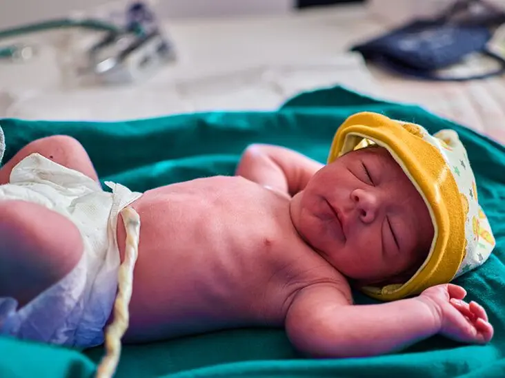 گره خوردن بند ناف