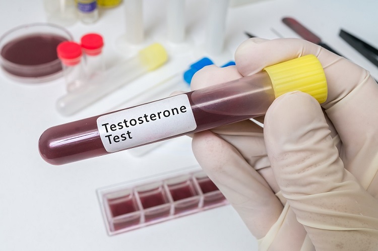 testosteronetestts1