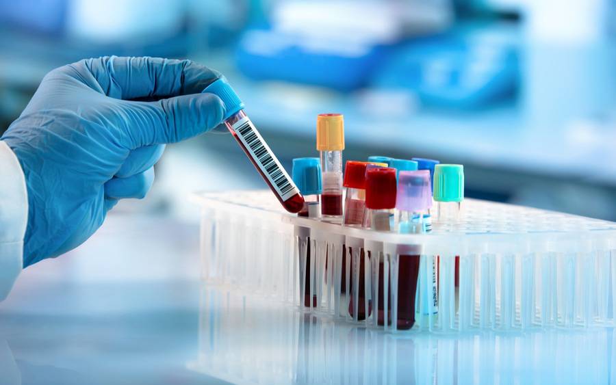 blood_test_samples_1200x750-59cd6b99366c6e716576ccd68351ed39