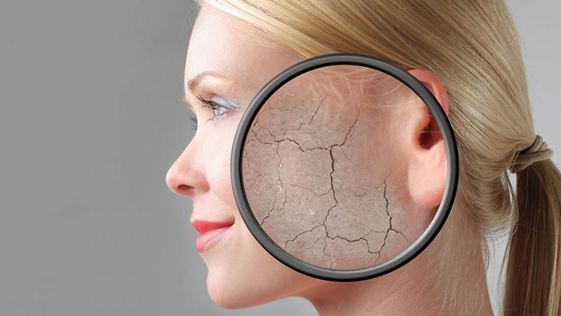 علل ایجاد لکه های خشکی روی پوست (پیشگیری + درمان)