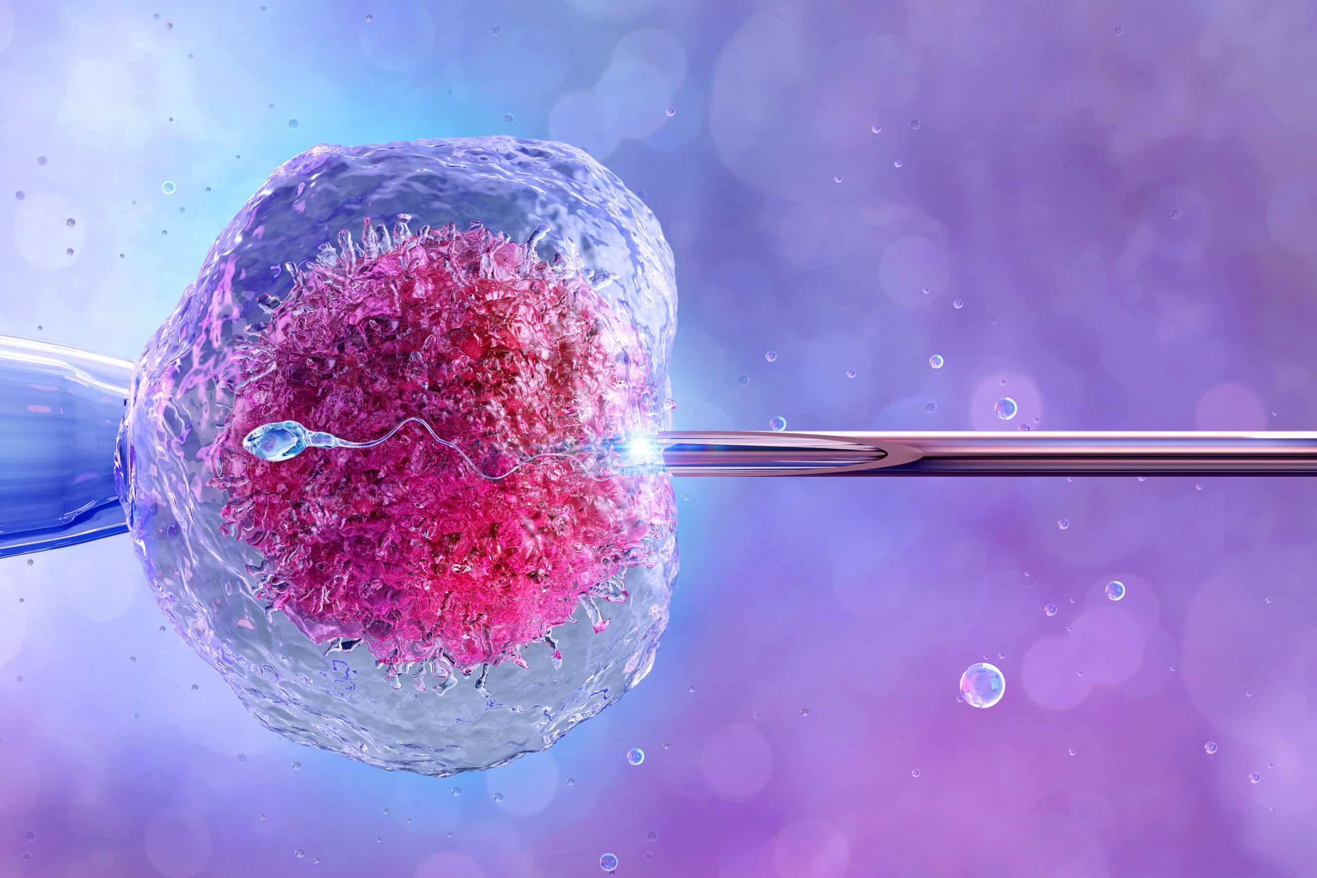 آی وی اف (IVF) چیست و چگونه عمل می‌کند؟