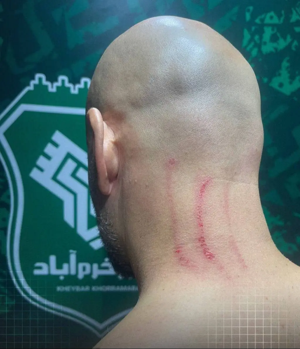 حمله به مربی استقلال