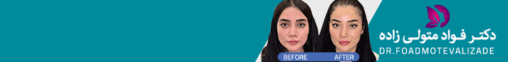 متولی زاده / بنر D5 