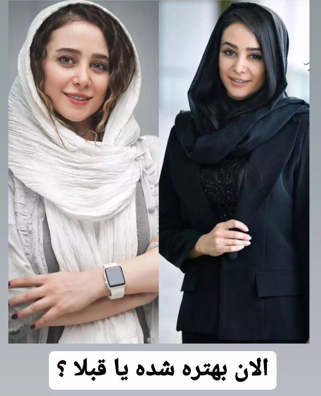 چهره جدید الناز حبیبی بعد از جراحی زیبایی / تغییرات خانم بازیگر در گذر زمان + عکس