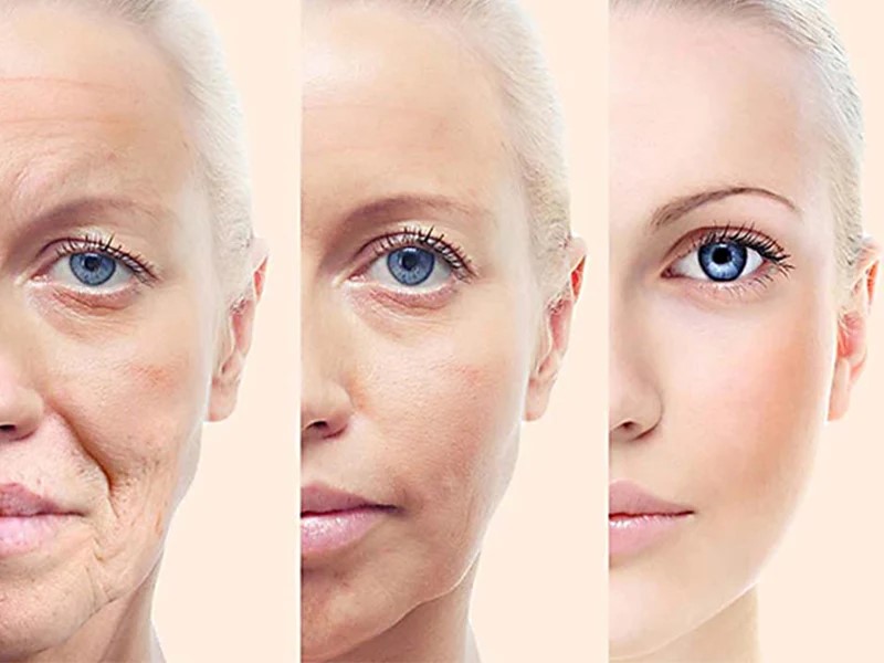 چه تغییراتی را پس از انجام هایفوتراپی مشاهده می کنیم؟