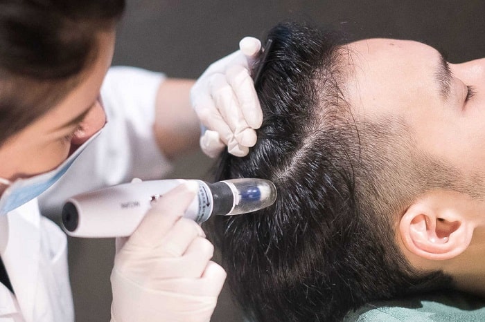 مزوتراپی مو، یک روش ویژه برای رهایی از ریزش مو!