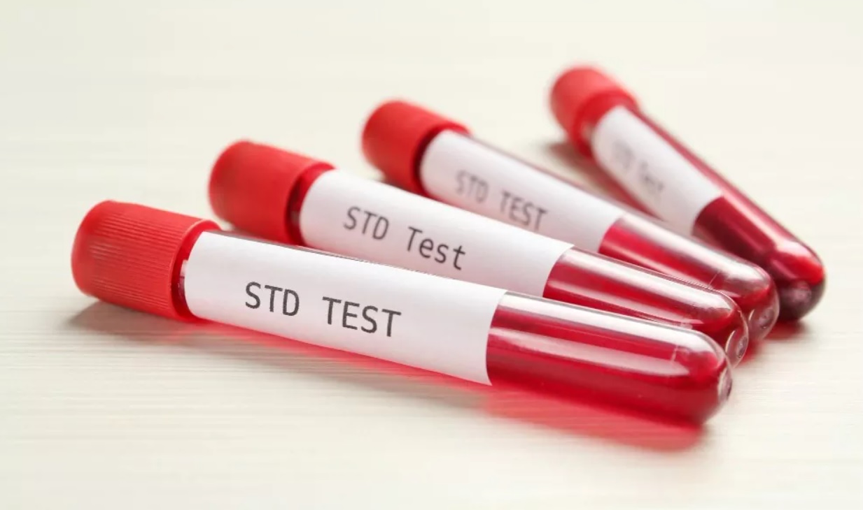 تست STD و نوع درمان آن