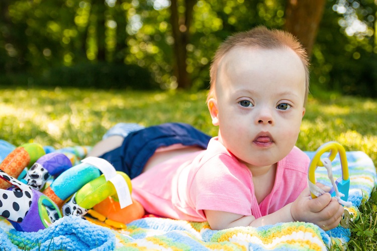 Baby+Boy+with+Down+Syndrome