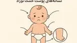 خشکی پوست نوزاد | ۶ علت شایع و راهکارهای درمان آن 