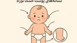 خشکی پوست نوزاد | ۶ علت شایع و راهکارهای درمان آن 