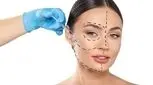 جوانسازی با اندولیفت چگونه انجام می‌شود؟