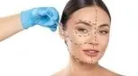 جوانسازی با اندولیفت چگونه انجام می‌شود؟