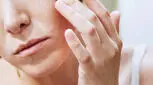 اگزما و استرس چه ارتباطی با هم دارند؟