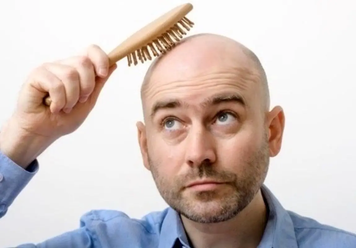 آشنایی با روش‌های کاشت مو در کلینیک زیبایی شن‌های نقره‌ای 