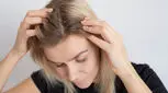 علت پوسته پوسته شدن سر چیست و چه راه حلی دارد ؟