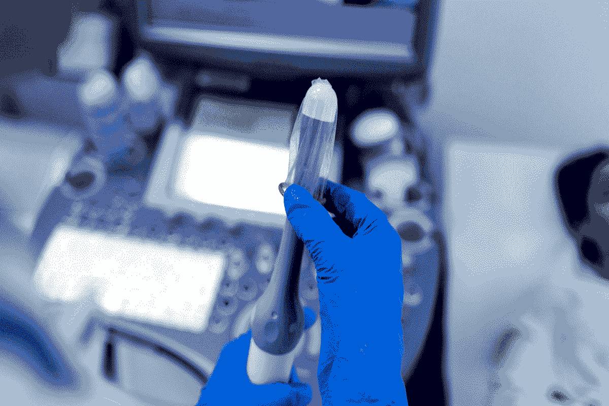 سونوگرافی واژینال یا شکمی، کدام بهتر است؟
