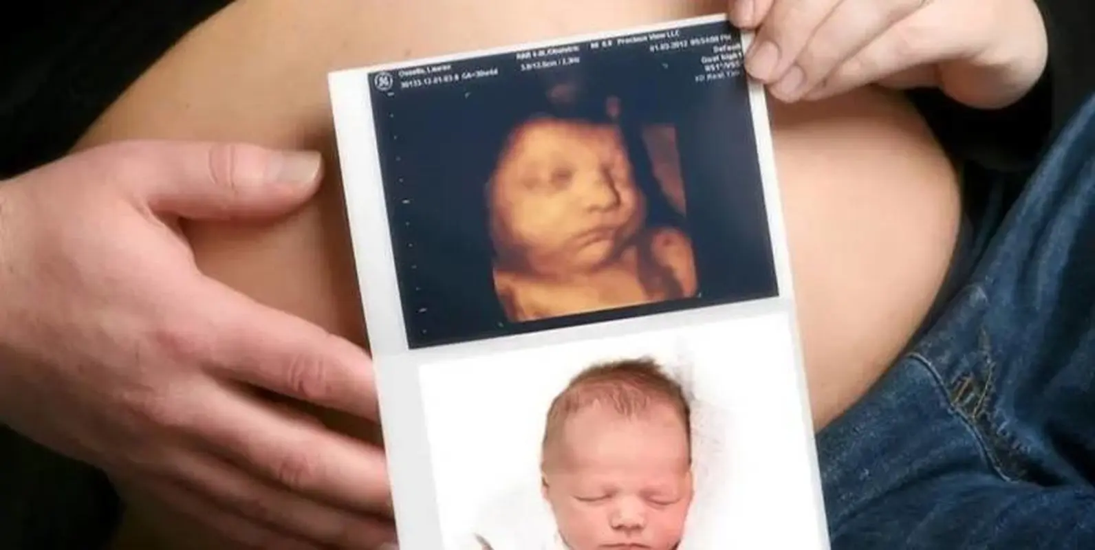 همه اطلاعات درباره سونوگرافی ۴ بعدی