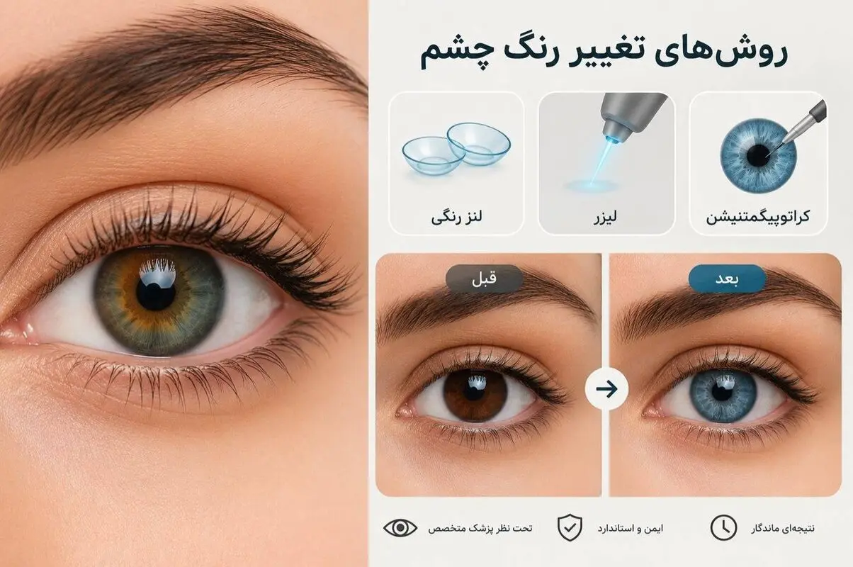 آیا تغییر رنگ چشم دائمی واقعاً امکان‌پذیر است؟