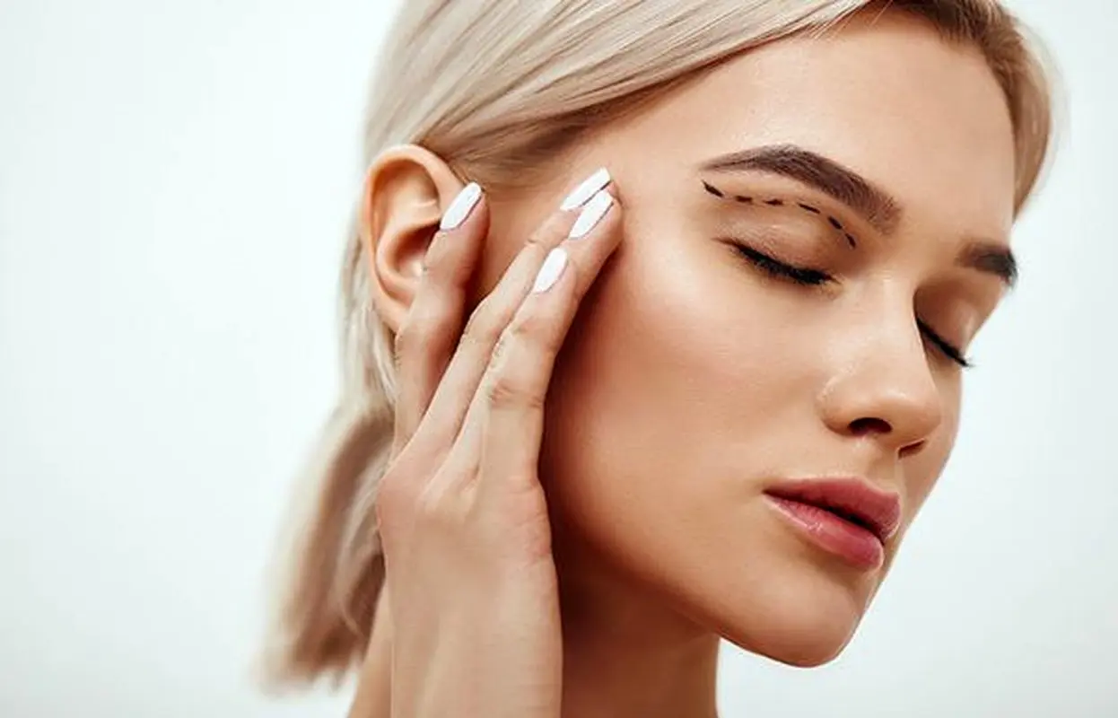 بلفاروپلاستی بدون اثری از جای بخیه