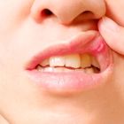 پس از «صورت اوزمپیک»، متخصصان درباره «دهان اوزمپیک» هشدار می‌‌دهند