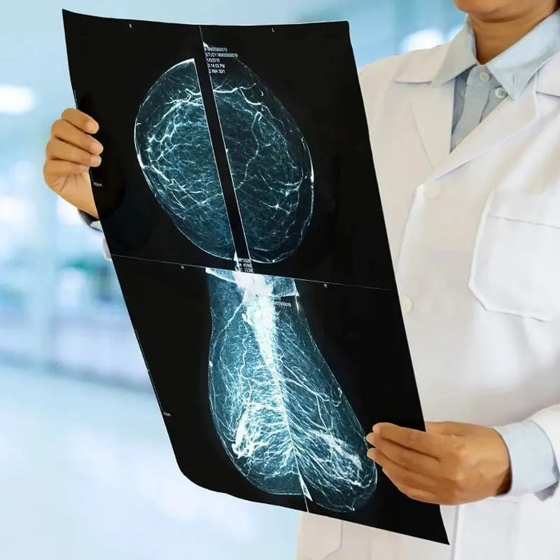 بهترین دکتر ماموگرافی، چطور انتخاب کنم؟