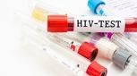 آزمایش رایگان و محرمانه HIV در این مراکز + آدرس