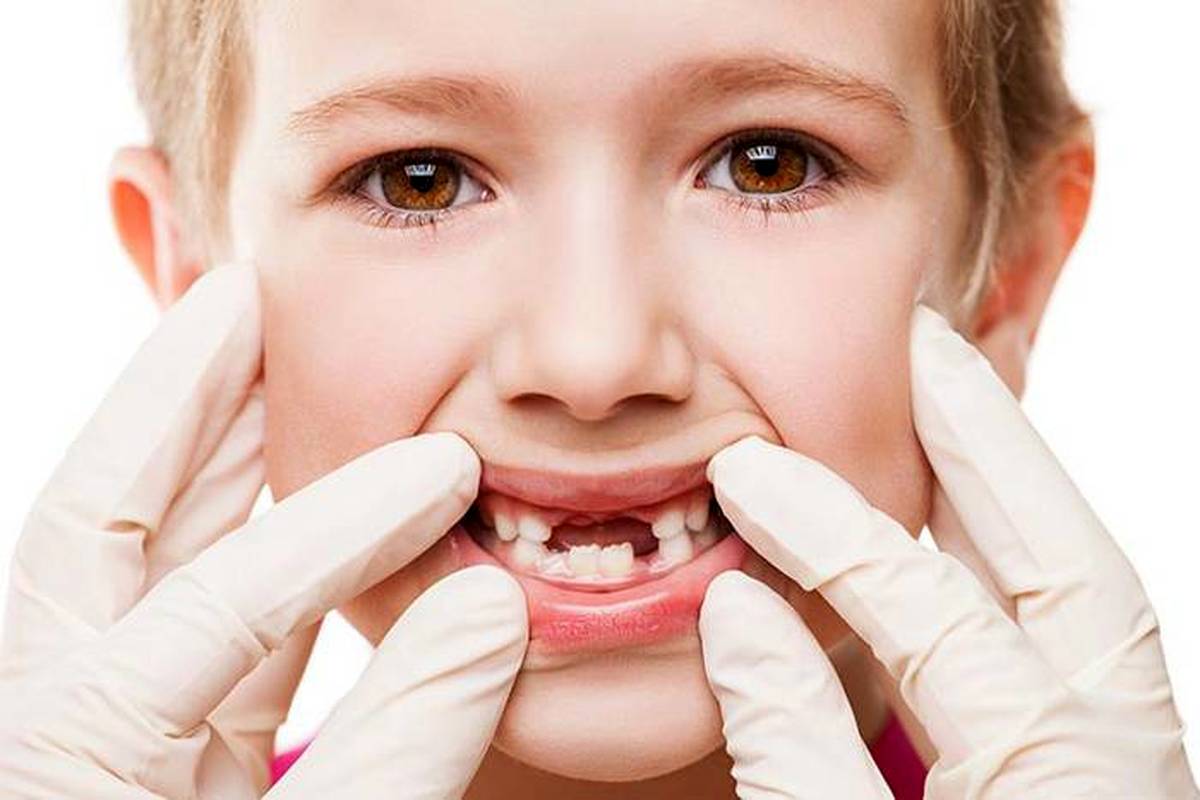 نقش دندان‌های شیری در سلامت کودکان 