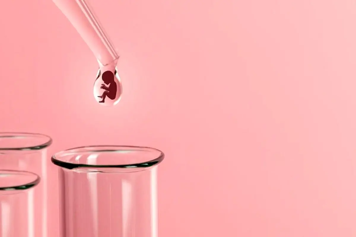تعیین جنسیت با روش iui 