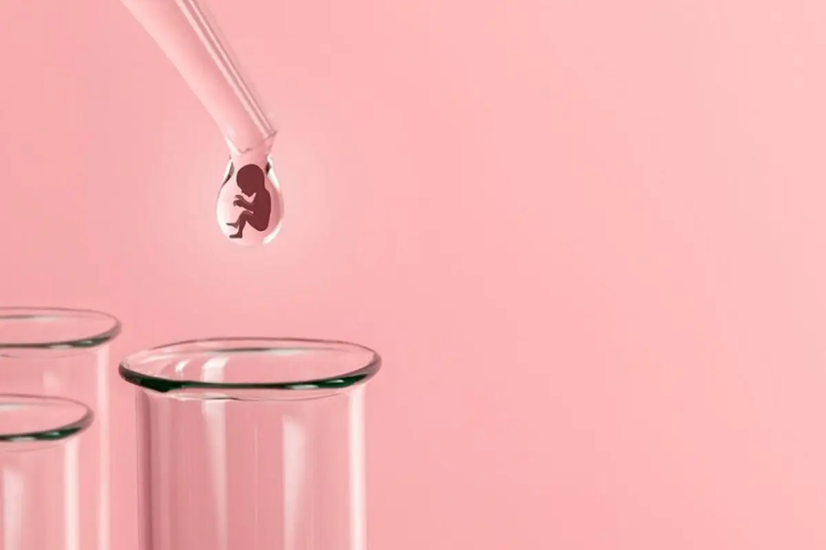 تعیین جنسیت با روش iui 