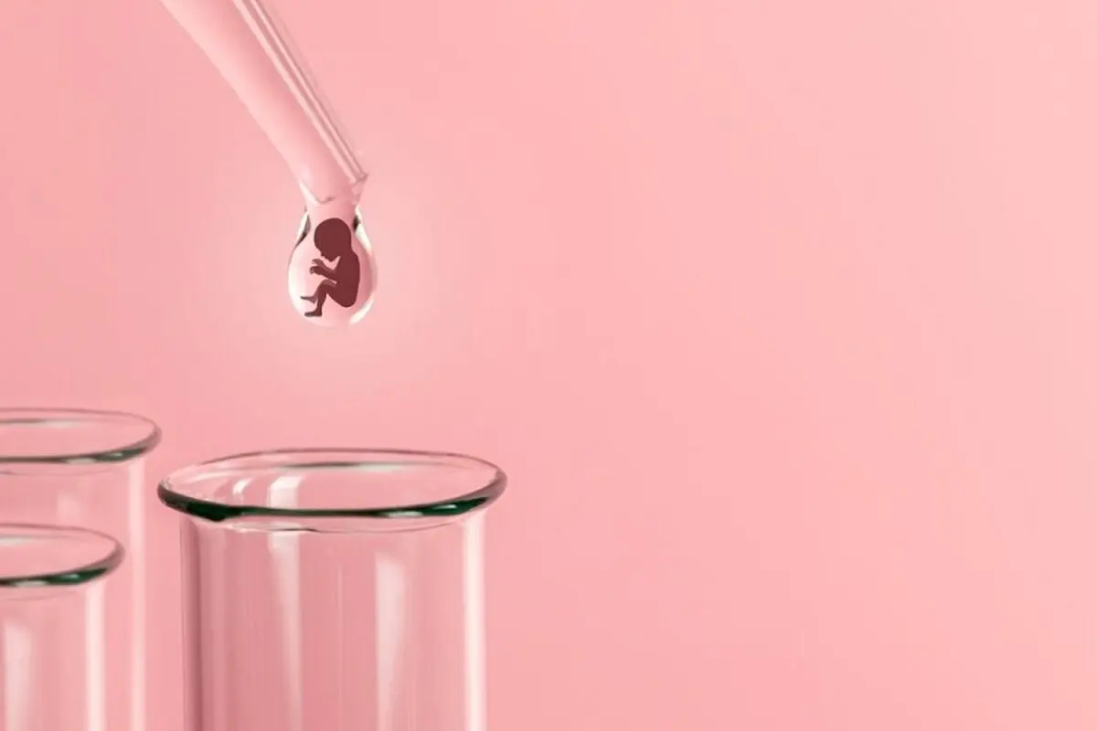 تعیین جنسیت با روش iui 