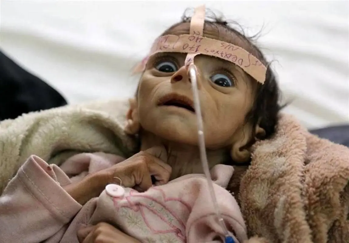 آیا وبا دوباره جهان را تهدید میکند؟ بازگشت بلای دوران ویکتوریا