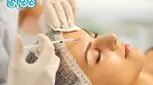 فیلر شقیقه | 6 مزیت، عوارض احتمالی و مراقبت های بعد تزریق + راهنما انتخاب فیلر