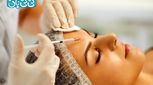 فیلر شقیقه | 6 مزیت، عوارض احتمالی و مراقبت های بعد تزریق + راهنما انتخاب فیلر