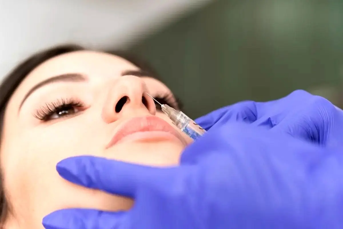 اصلاح فرم بینی با تزریق فیلر چگونه انجام می‌شود؟