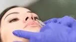 اصلاح فرم بینی با تزریق فیلر چگونه انجام می‌شود؟