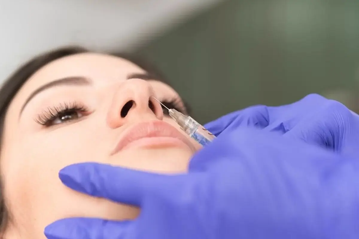 اصلاح فرم بینی با تزریق فیلر چگونه انجام می‌شود؟