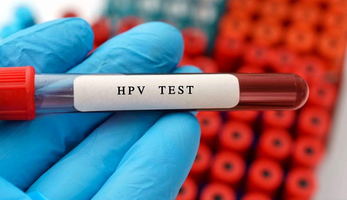 خیلی رُک و صریح؛ راه‌حل قطعی عدم ابتلا به HPV پیدا شد