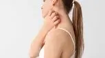 پژوهش جدید: خاراندن پوست به کاهش باکتری‌ها کمک می‌کند