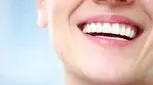 اصلاح طرح لبخند با کامپوزیت چگونه انجام می‌شود؟