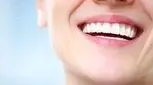 اصلاح طرح لبخند با کامپوزیت چگونه انجام می‌شود؟